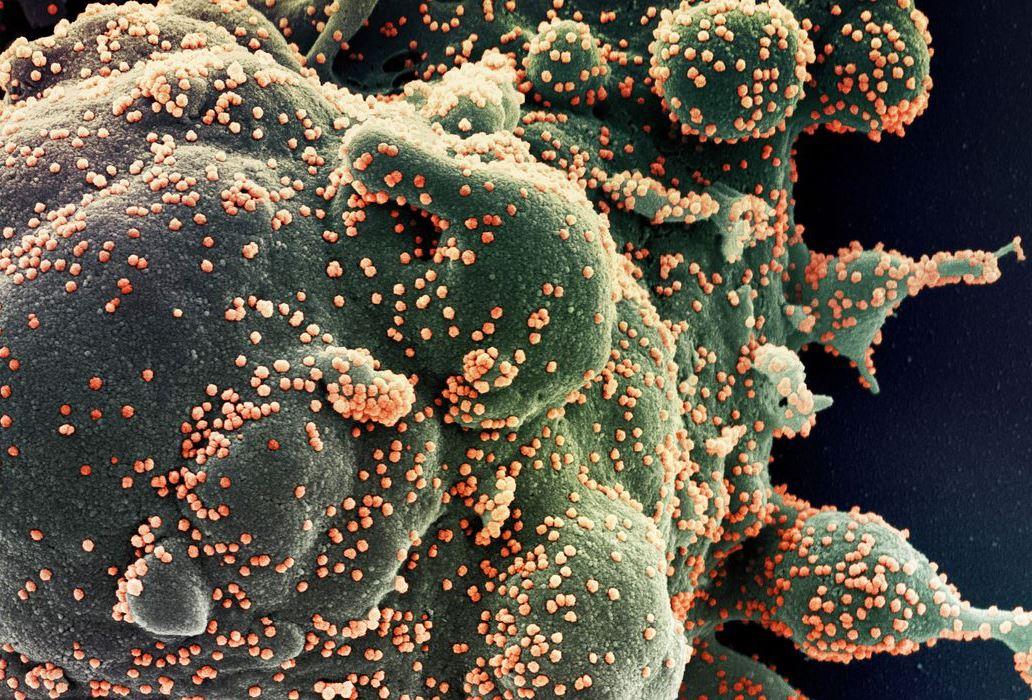  Fiocruz identifica subvariante BA.5.3.1 do coronavírus no Amazonas 