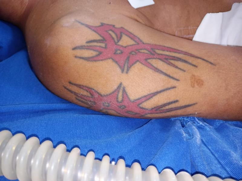 HPS João Lúcio procura familiares de paciente sem identificação internado na unidade