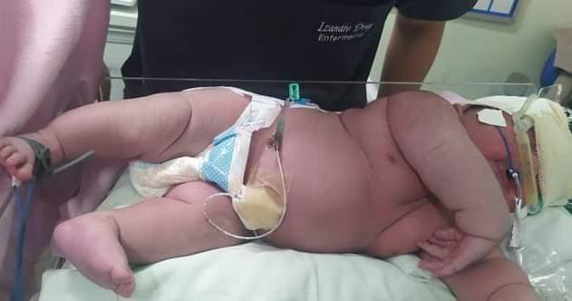 Hospital de Parintins registra nascimento de um dos maiores bebês da história