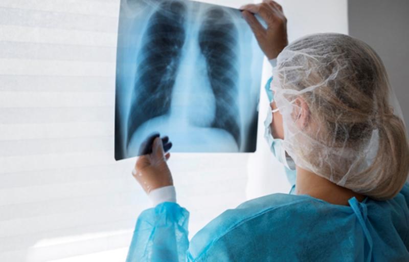 Tuberculose: Brasil está no grupo de países responsáveis por 82% de casos no mundo