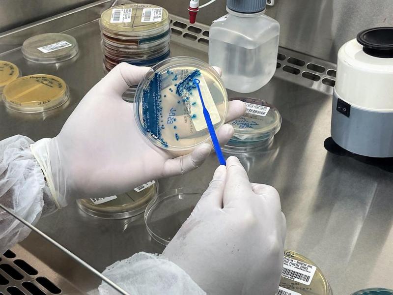 Único da Região Norte, Amazonas integra iniciativa internacional de monitoramento de resistência de bactérias a tratamentos