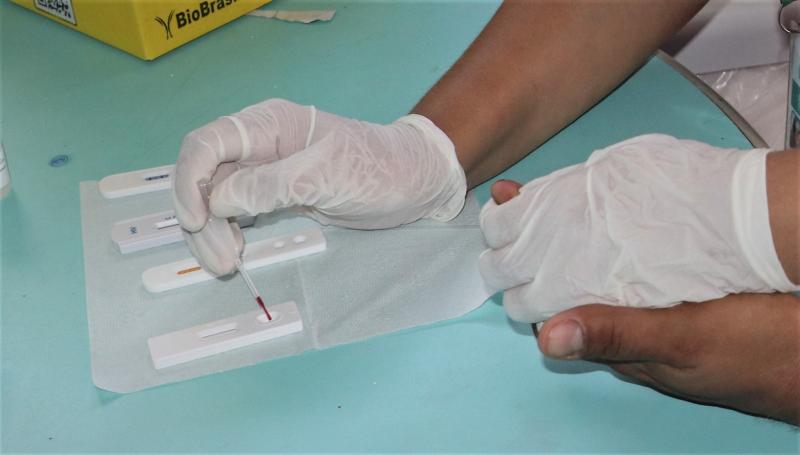 Prevenção combinada contra IST’s é medida para manter a saúde sexual durante Festival