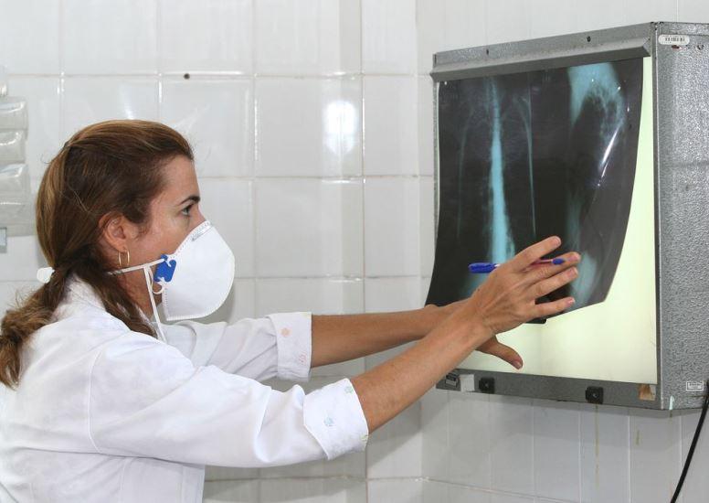 Tuberculose: medicamento para tratamento mais curto está sob consulta