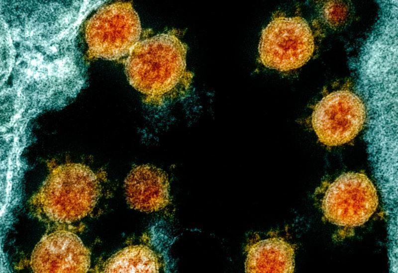 Mais de 50% da população quer julgamentos por mortes de covid-19