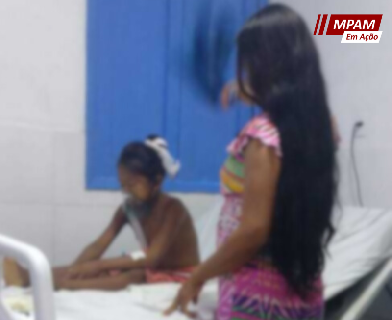 MPAM obtém decisão da Justiça que assegura intervenção médica urgente em favor de uma criança indígena de Amaturá