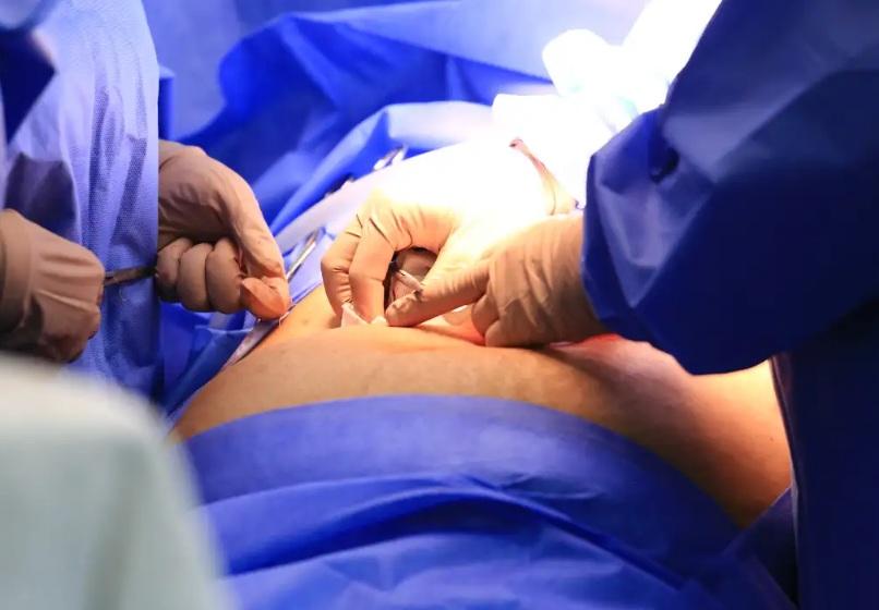Cinco estados podem zerar fila de cirurgias no SUS