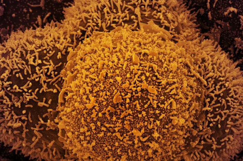 Nova subvariante da covid-19 é identificada em Mato Grosso