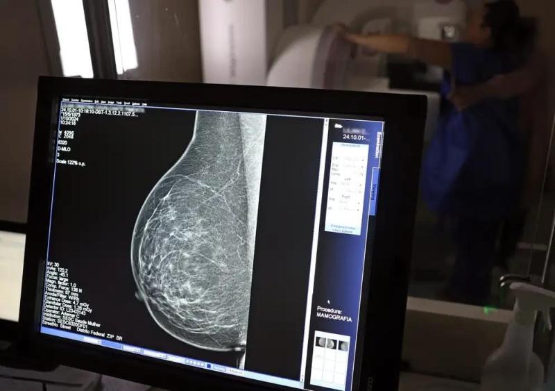 Quase 70% dos brasileiros consideram câncer evitável, apesar de 65% não saberem como se prevenir