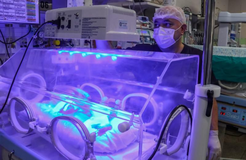 Maternidade Ana Braga inova com uso de equipamento de ponta no diagnóstico de icterícia neonatal