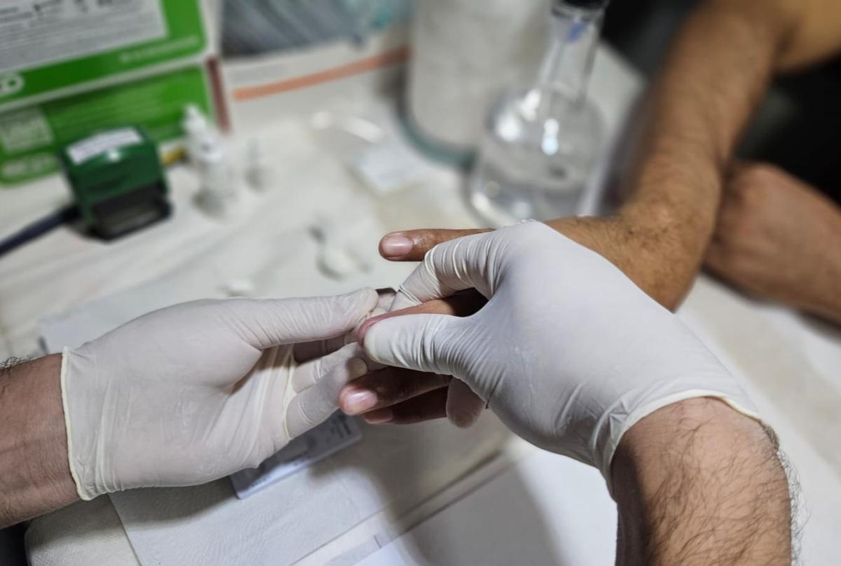 Amazonas tem redução de 20,7% na mortalidade por Aids