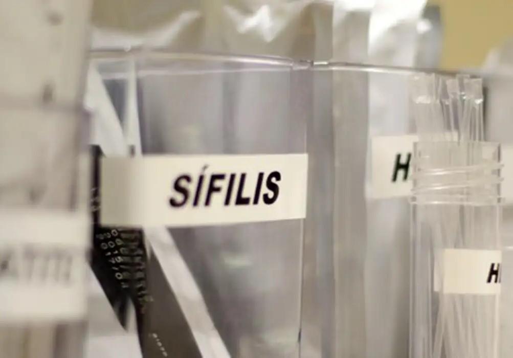 SUS passa a adotar antibiótico para prevenir sífilis e clamídia