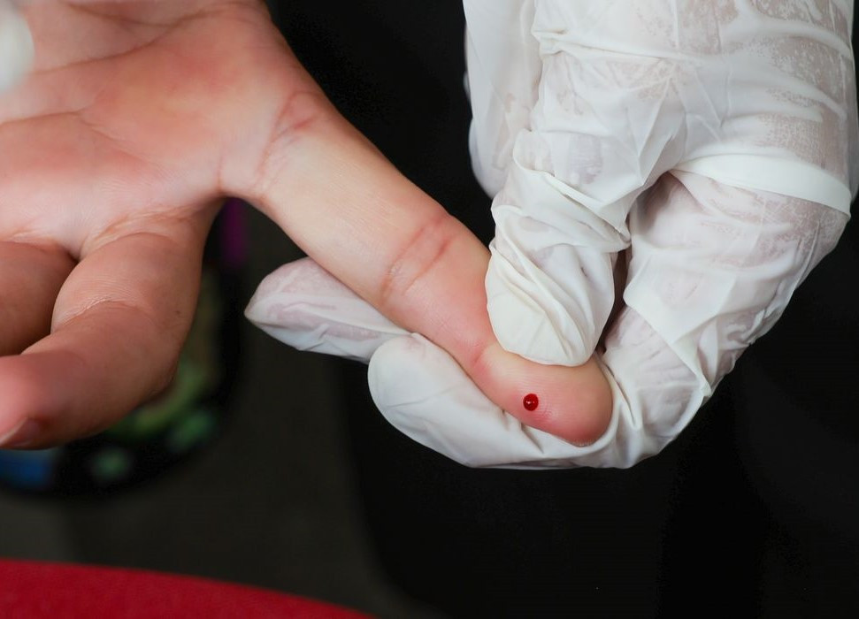 SUS passa a oferecer teste rápido de dengue