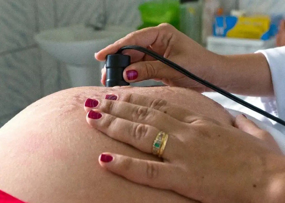 Risco de morte materna cai até 31% entre quem recebe o Bolsa Família