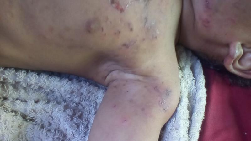 Acusado de torturar o filho com mordidas se apresenta na Polícia Civil em Parintins Acusado de torturar o filho com mordidas se apresenta na Polícia Civil em Parintins