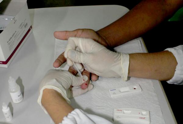 Aids faz novas vítimas em Parintins e homens são os mais vulneráveis
