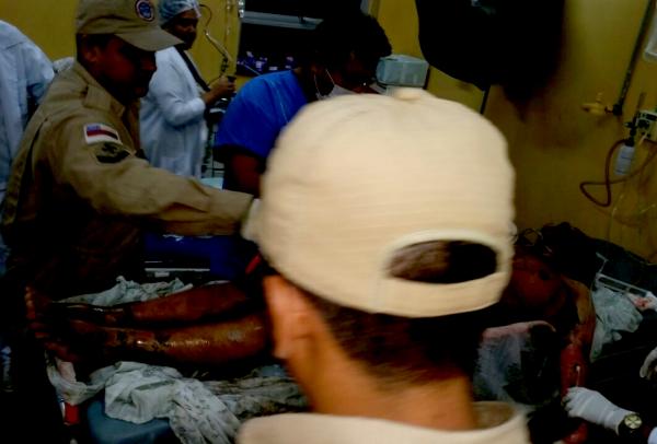 Mulher queimada pelo marido em Parintins morre no hospital 28 de Agosto em Manaus