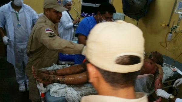 Mulher tem 90% do corpo queimado com gasolina por ex-marido