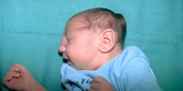 Pesticida colocado na água potável seria o responsável pelo surto de microcefalia no Brasil, e não o Zika, diz relatório